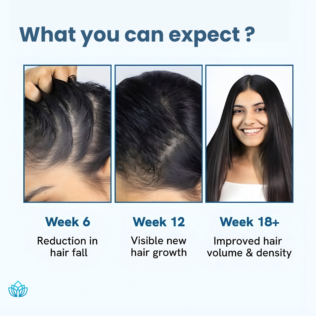 Eledeep Bodywise Hair Growth Serum